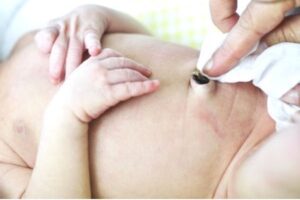 como limpar o coto umbilical do bebê
